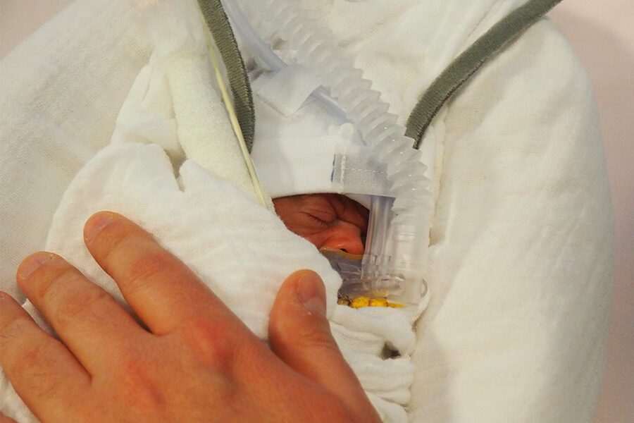 Prématurité bébé livre naissance